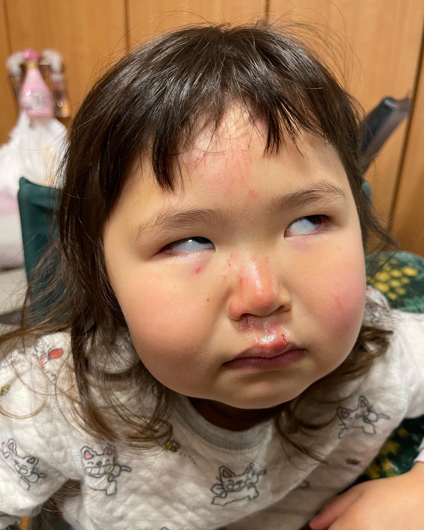 転けた

パパと遊んでいたら転けて怪我しました🤕
痛そう
しばらくはこの顔かぁ…
早く治りますように